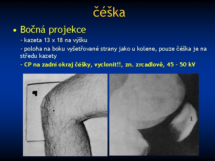 čéška • Bočná projekce - kazeta 13 x 18 na výšku - poloha na