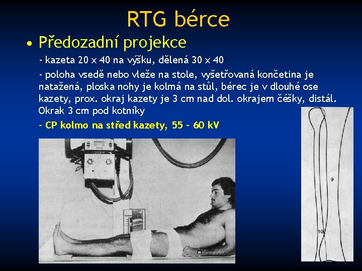 RTG bérce • Předozadní projekce - kazeta 20 x 40 na výšku, dělená 30