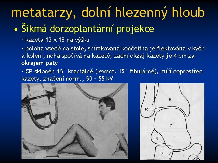 metatarzy, dolní hlezenný hloub • Šikmá dorzoplantární projekce - kazeta 13 x 18 na