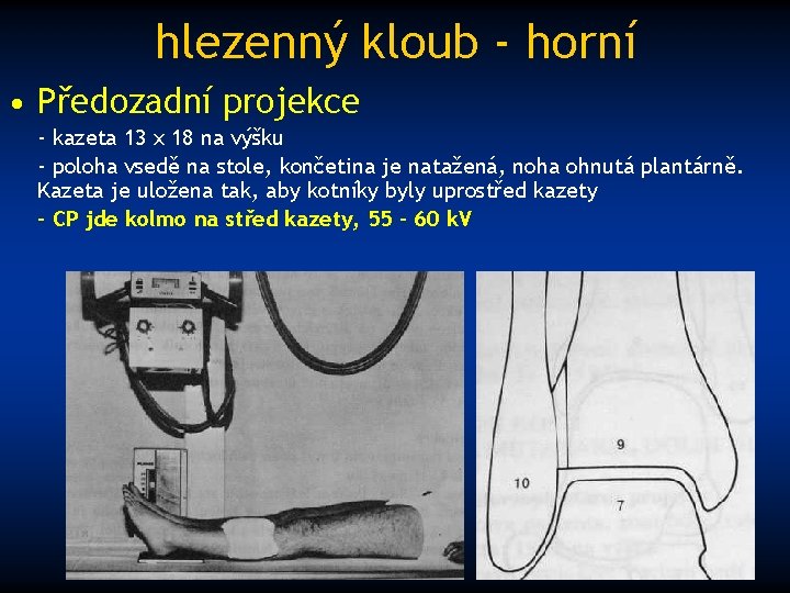 hlezenný kloub - horní • Předozadní projekce - kazeta 13 x 18 na výšku