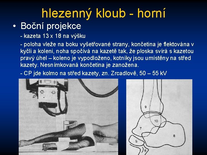 hlezenný kloub - horní • Boční projekce - kazeta 13 x 18 na výšku