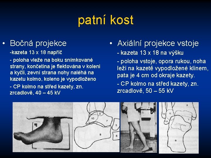 patní kost • Bočná projekce -kazeta 13 x 18 napříč - poloha vleže na