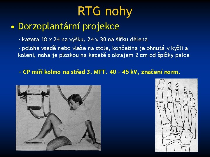 RTG nohy • Dorzoplantární projekce - kazeta 18 x 24 na výšku, 24 x