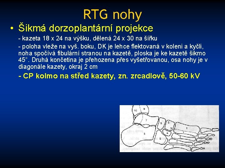 RTG nohy • Šikmá dorzoplantární projekce - kazeta 18 x 24 na výšku, dělená