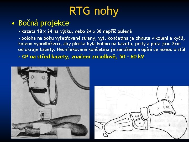 RTG nohy • Bočná projekce - kazeta 18 x 24 na výšku, nebo 24