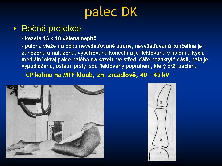 palec DK • Bočná projekce - kazeta 13 x 18 dělená napříč - poloha