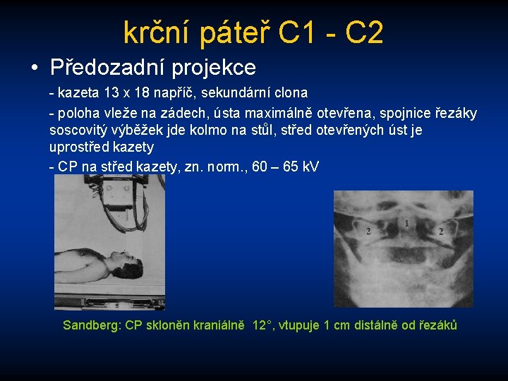 krční páteř C 1 - C 2 • Předozadní projekce - kazeta 13 x