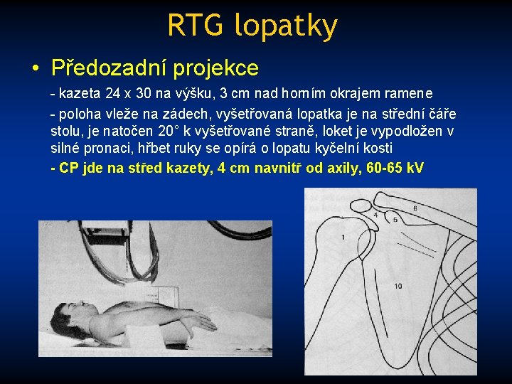 RTG lopatky • Předozadní projekce - kazeta 24 x 30 na výšku, 3 cm