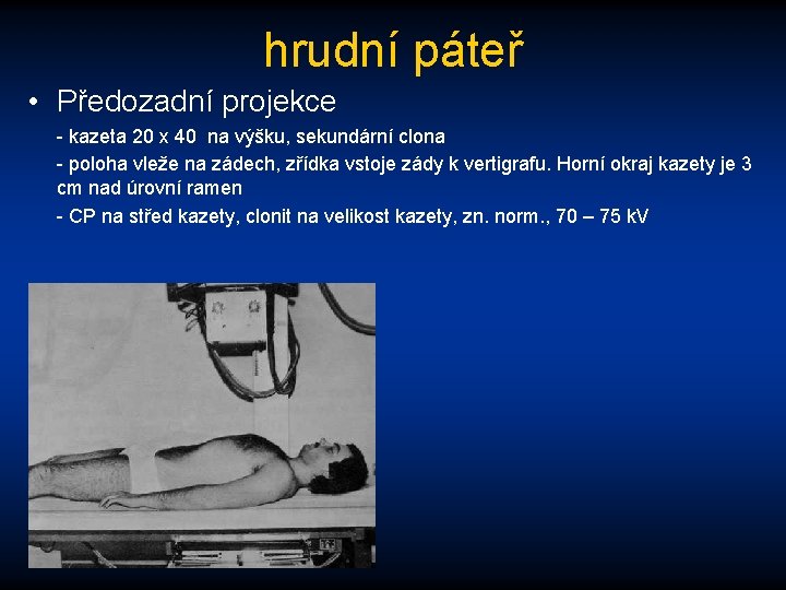 hrudní páteř • Předozadní projekce - kazeta 20 x 40 na výšku, sekundární clona