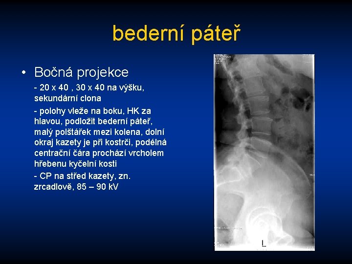 bederní páteř • Bočná projekce - 20 x 40 , 30 x 40 na