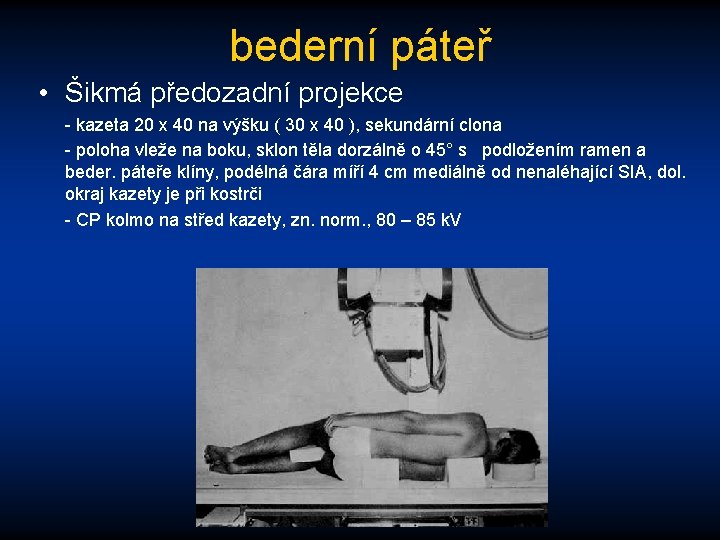 bederní páteř • Šikmá předozadní projekce - kazeta 20 x 40 na výšku (