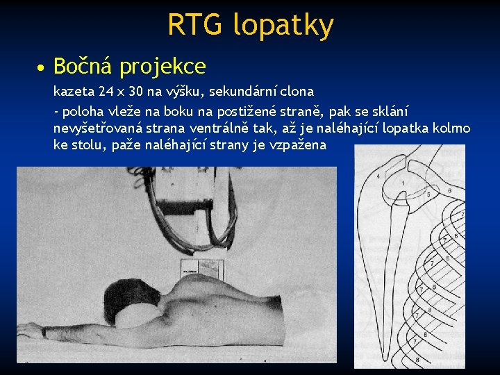 RTG lopatky • Bočná projekce kazeta 24 x 30 na výšku, sekundární clona -