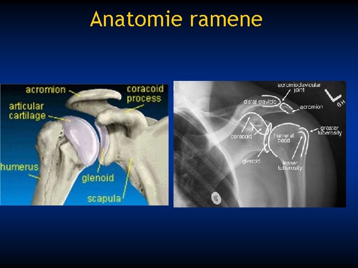 Anatomie ramene 