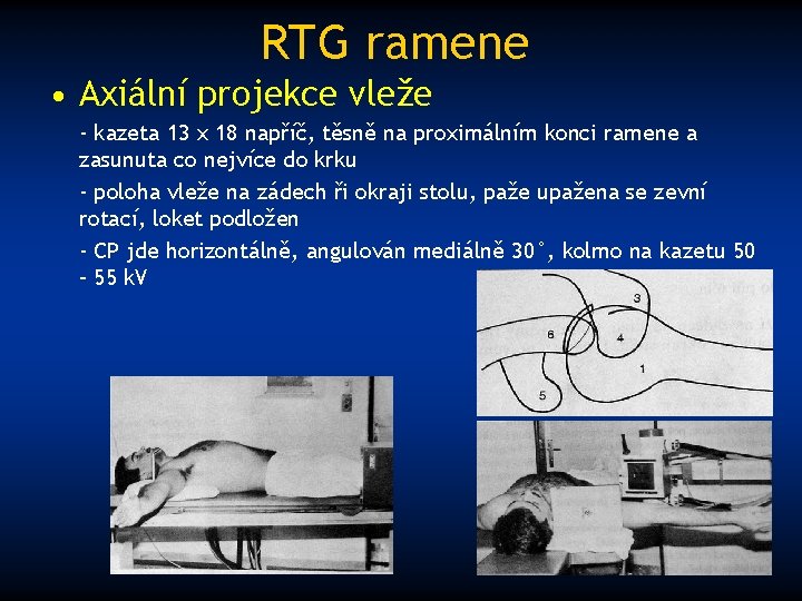 RTG ramene • Axiální projekce vleže - kazeta 13 x 18 napříč, těsně na