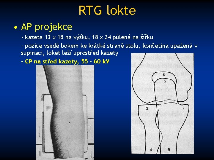 RTG lokte • AP projekce - kazeta 13 x 18 na výšku, 18 x