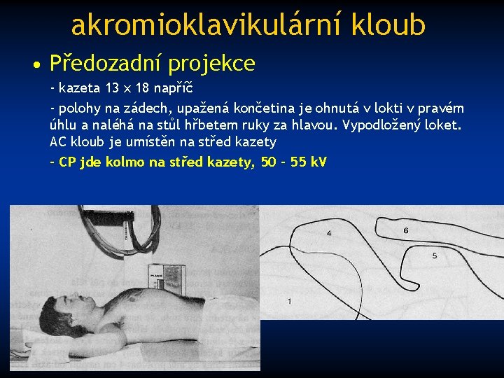 akromioklavikulární kloub • Předozadní projekce - kazeta 13 x 18 napříč - polohy na