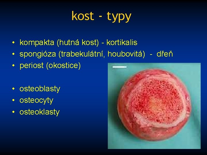 kost - typy • kompakta (hutná kost) - kortikalis • spongióza (trabekulátní, houbovitá) -