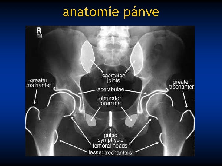 anatomie pánve 