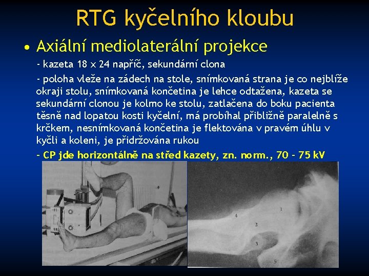 RTG kyčelního kloubu • Axiální mediolaterální projekce - kazeta 18 x 24 napříč, sekundární