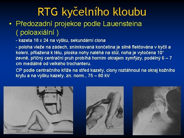 RTG kyčelního kloubu • Předozadní projekce podle Lauensteina ( poloaxiální ) - kazeta 18