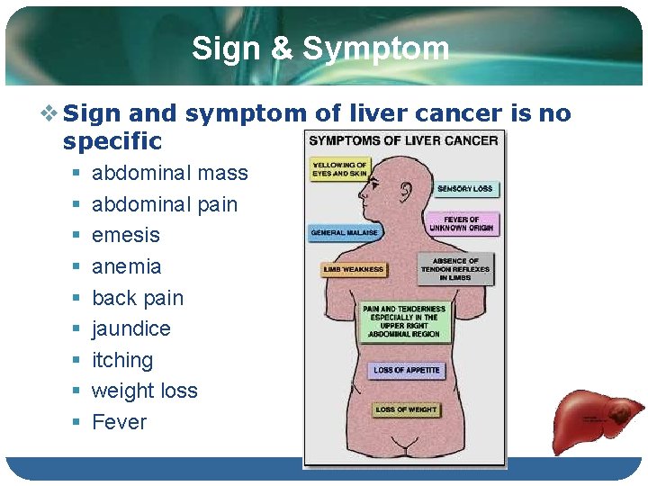 Sign & Symptom Sign and symptom of liver cancer is no specific abdominal mass