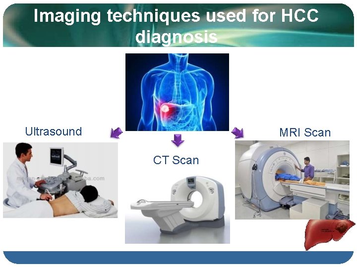Imaging techniques used for HCC diagnosis Ultrasound MRI Scan CT Scan 