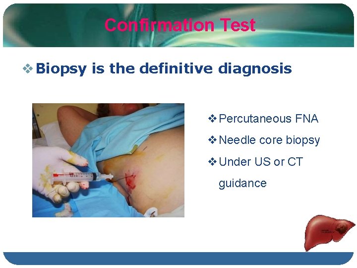 Confirmation Test Biopsy is the definitive diagnosis Percutaneous FNA Needle core biopsy Under US