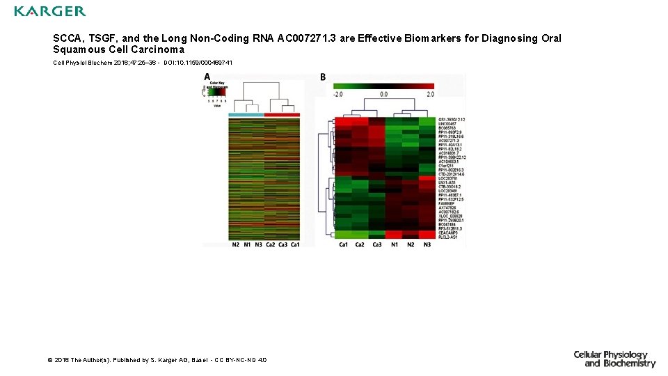 SCCA, TSGF, and the Long Non-Coding RNA AC 007271. 3 are Effective Biomarkers for