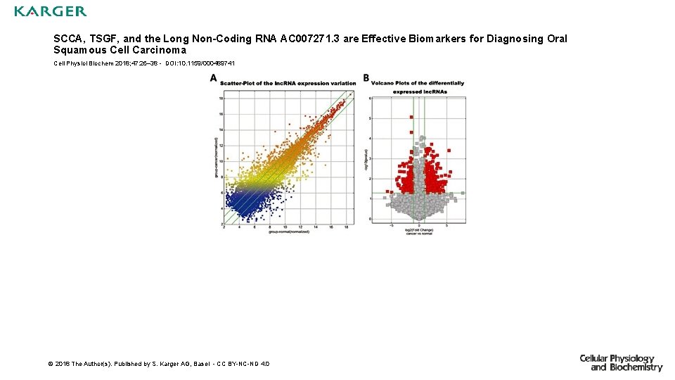 SCCA, TSGF, and the Long Non-Coding RNA AC 007271. 3 are Effective Biomarkers for