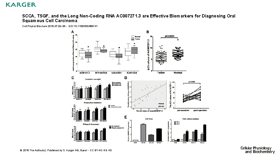 SCCA, TSGF, and the Long Non-Coding RNA AC 007271. 3 are Effective Biomarkers for