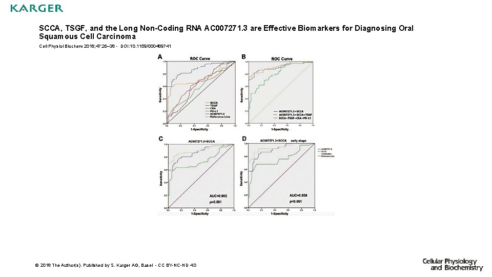 SCCA, TSGF, and the Long Non-Coding RNA AC 007271. 3 are Effective Biomarkers for