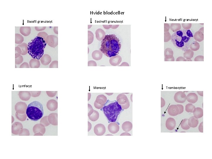 Hvide blodceller Basofil granulocyt Lymfocyt Eosinofil granulocyt Monocyt Neutrofil granulocyt Trombocytter 