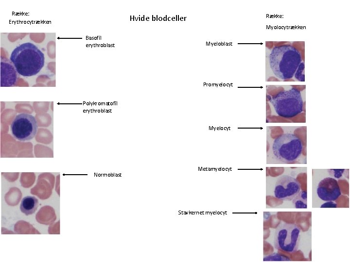 Række: Erythrocytrækken Hvide blodceller Række: Myolocytrækken Basofil erythroblast Myeloblast Promyelocyt Polykromatofil erythroblast Myelocyt Normoblast