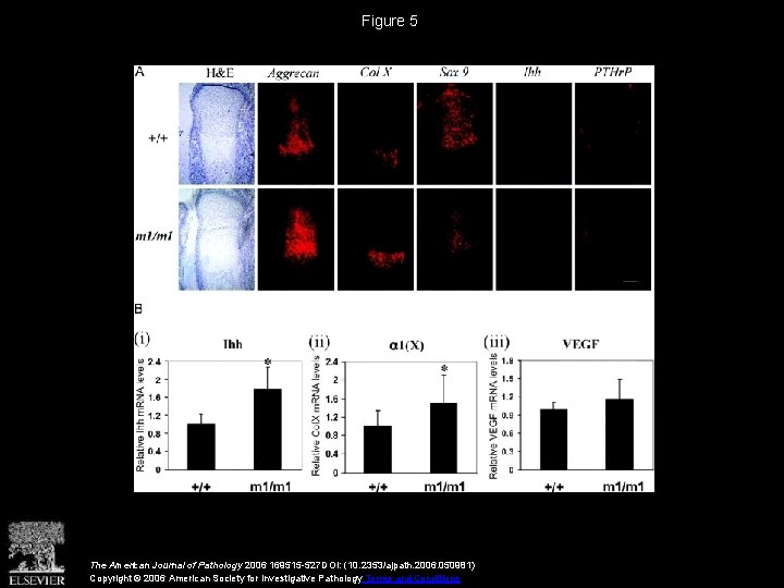 Figure 5 The American Journal of Pathology 2006 169515 -527 DOI: (10. 2353/ajpath. 2006.