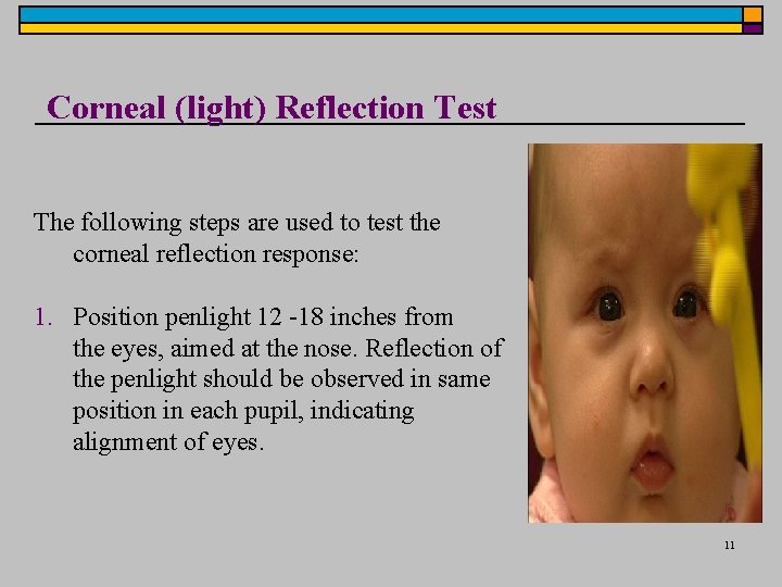 Corneal (light) Reflection Test The following steps are used to test the corneal reflection