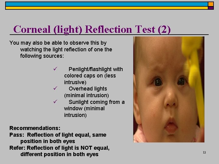 Corneal (light) Reflection Test (2) You may also be able to observe this by