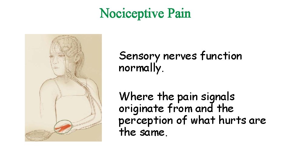 Nociceptive Pain Sensory nerves function normally. Where the pain signals originate from and the