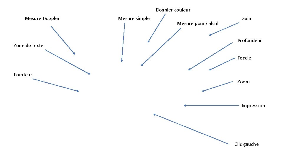 Doppler couleur Mesure Doppler Zone de texte Mesure simple Mesure pour calcul Gain Profondeur
