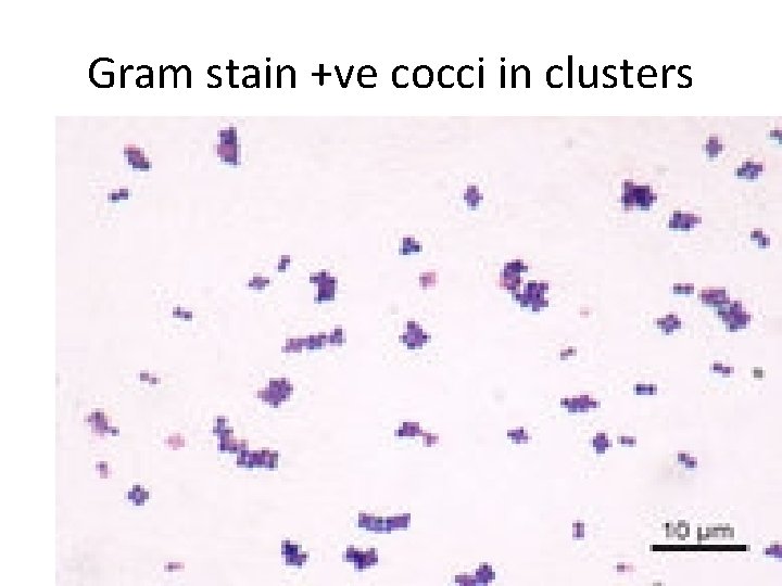 Gram stain +ve cocci in clusters 