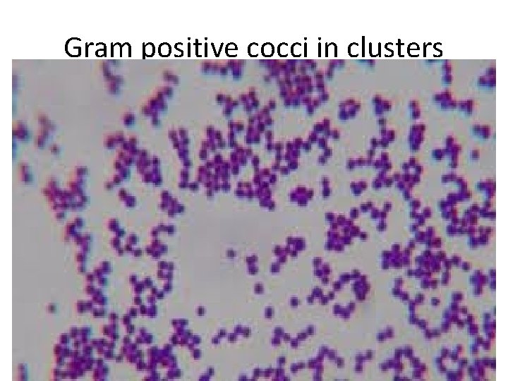Gram positive cocci in clusters 