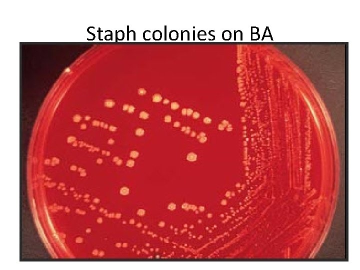 Staph colonies on BA 