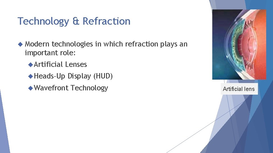 Technology & Refraction Modern technologies in which refraction plays an important role: Artificial Lenses