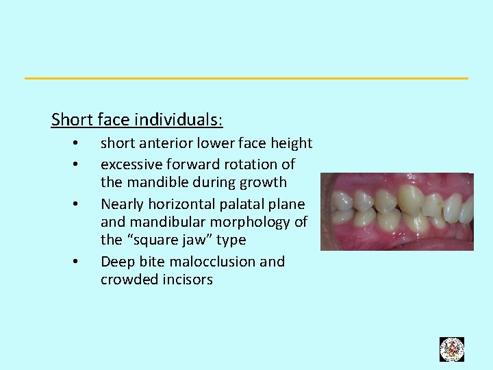 Short face individuals: • • short anterior lower face height excessive forward rotation of