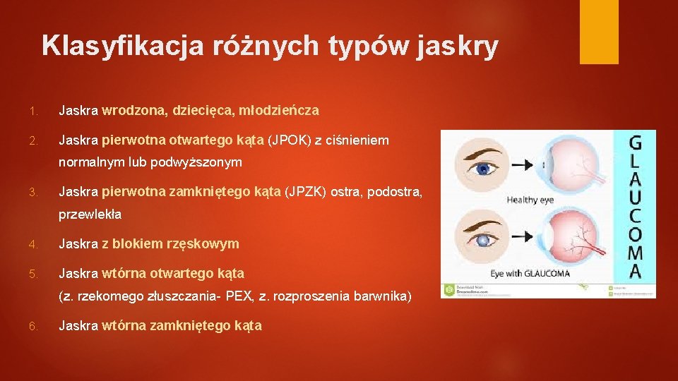 Klasyfikacja różnych typów jaskry 1. Jaskra wrodzona, dziecięca, młodzieńcza 2. Jaskra pierwotna otwartego kąta