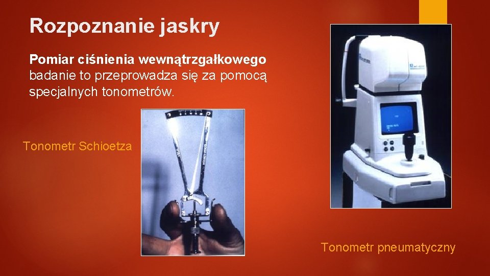 Rozpoznanie jaskry Pomiar ciśnienia wewnątrzgałkowego badanie to przeprowadza się za pomocą specjalnych tonometrów. Tonometr