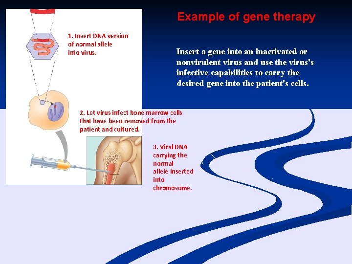 Example of gene therapy 1. Insert DNA version of normal allele into virus. Insert