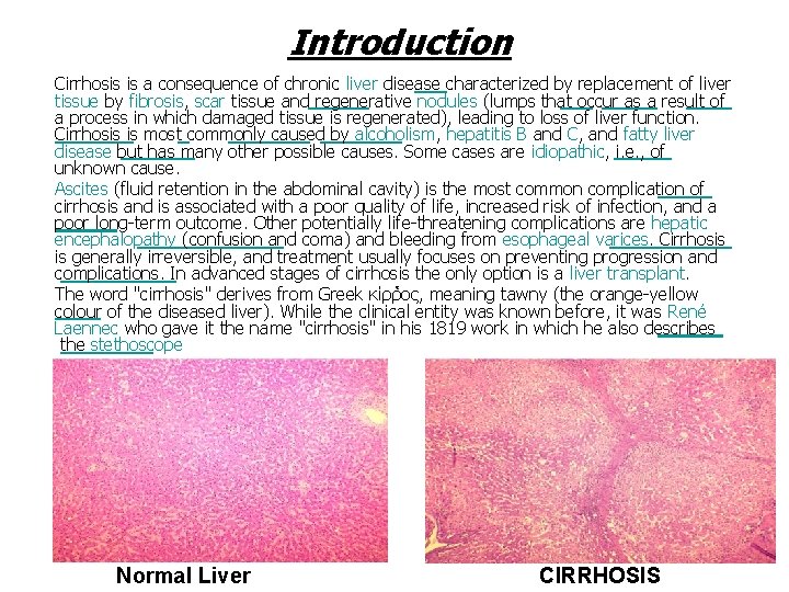 Introduction Cirrhosis is a consequence of chronic liver disease characterized by replacement of liver