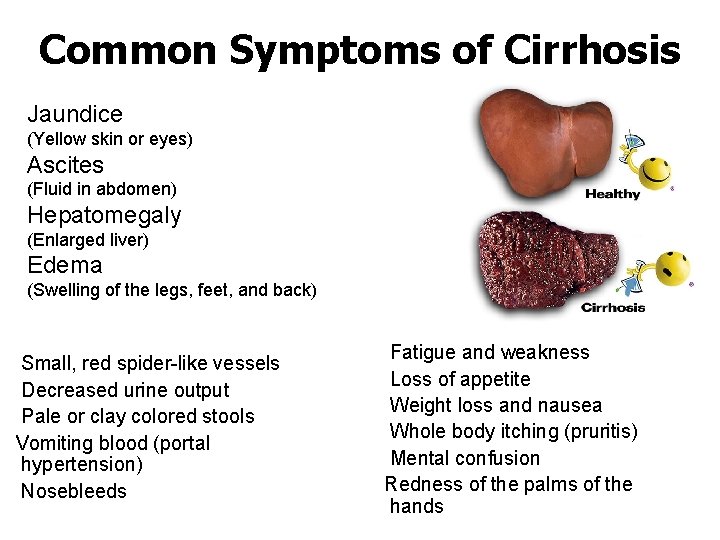 Common Symptoms of Cirrhosis Jaundice (Yellow skin or eyes) Ascites (Fluid in abdomen) Hepatomegaly