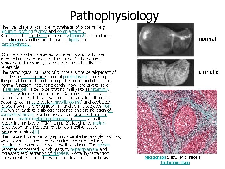 Pathophysiology The liver plays a vital role in synthesis of proteins (e. g. ,