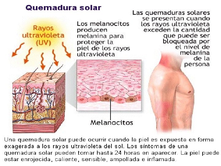 Radiació 